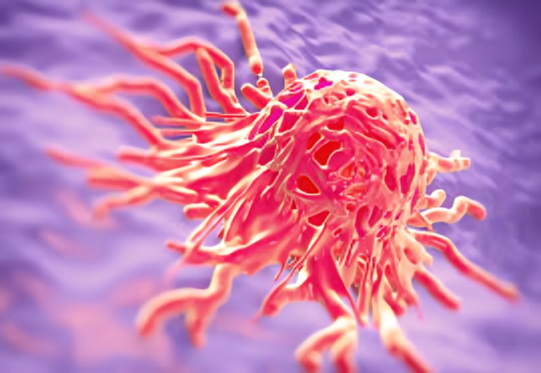 Cervical Cancer: Understanding, Prevention, and Empowering Health.