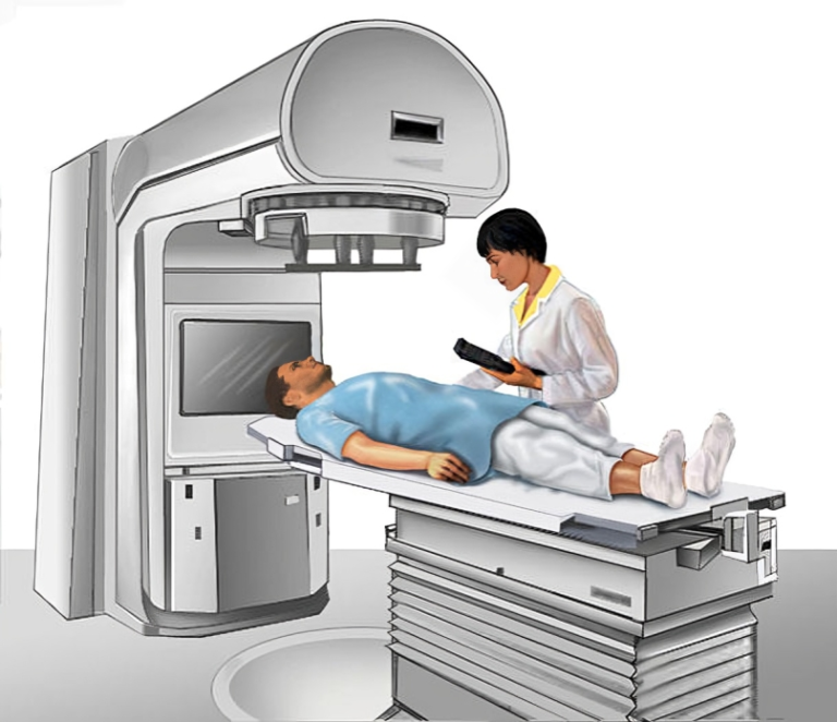 Navigating the Healing Power of Radiation Therapy: Understanding the Basics, Applications, and Advancements.